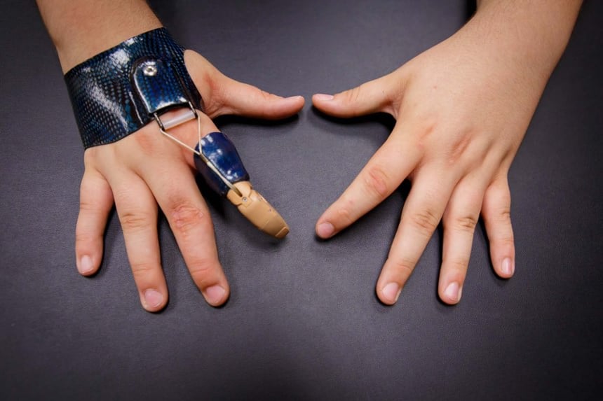 Body-powered partial hand prosthesis