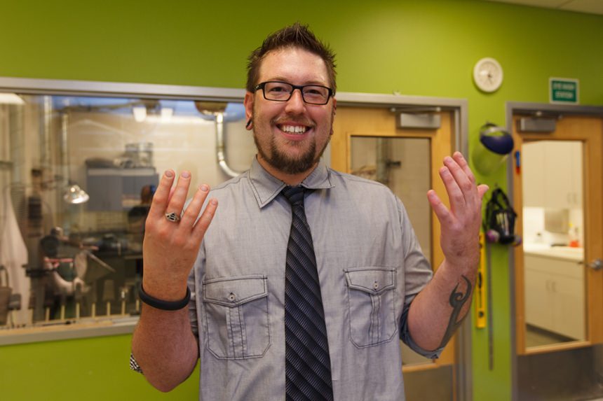 Passive Partial Hand Prosthesis photo