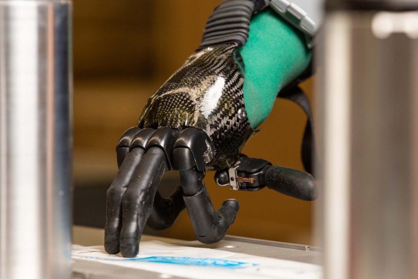 Electrically powered partial hand prosthesis photo