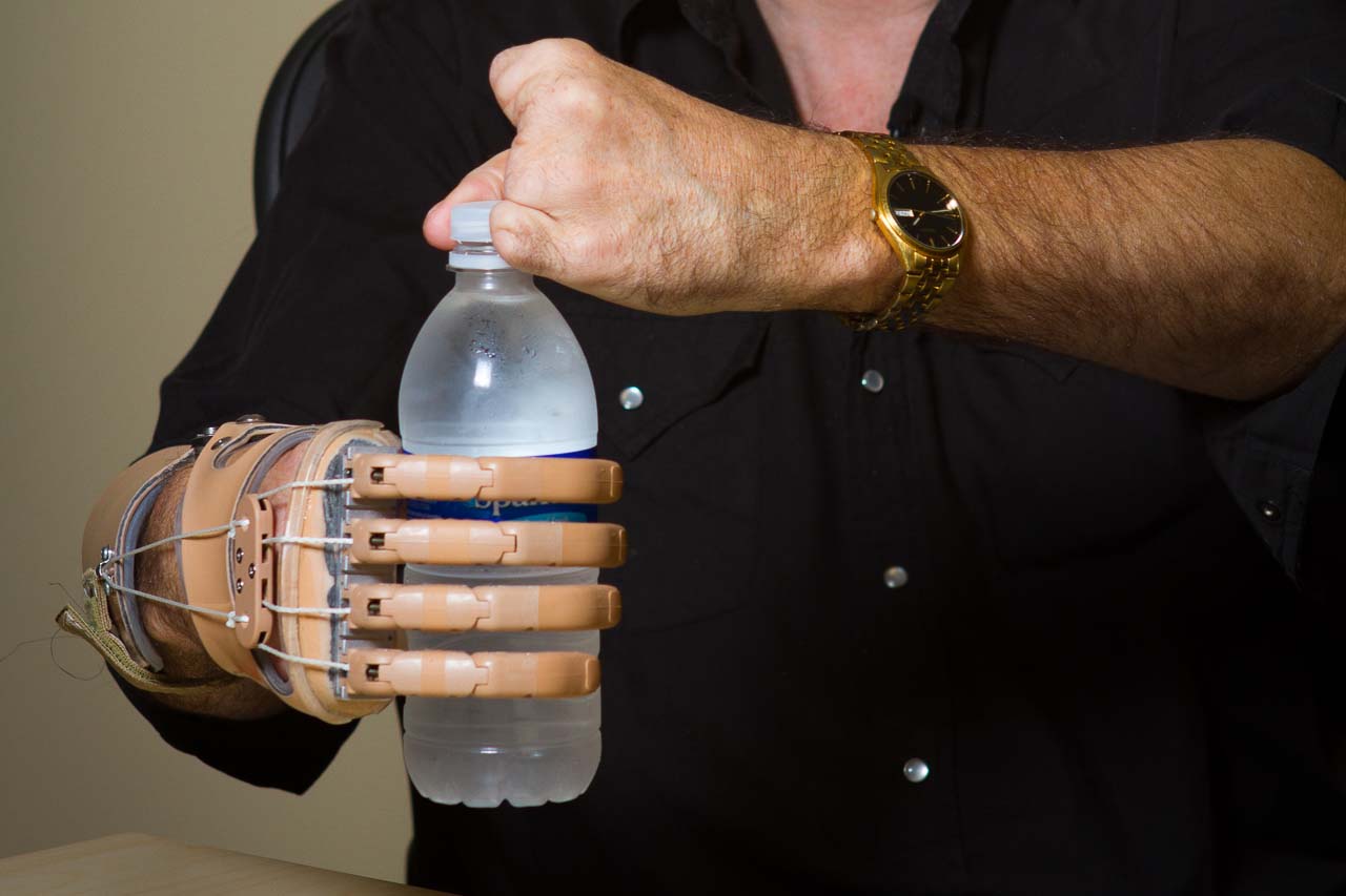 Body-powered partial hand prosthesis