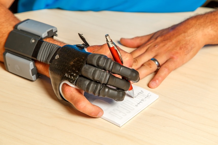 Arm Dynamics patient using his myoelectric finger prosthesis to write
