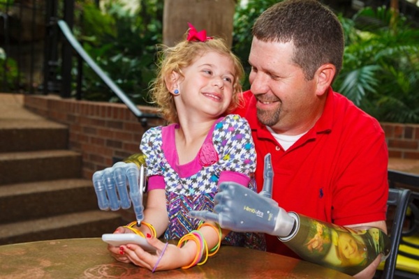 Arm Dynamics bilateral amputee patient with his daughter