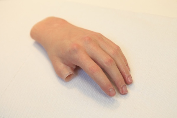 Completed silicone restoration prosthesis