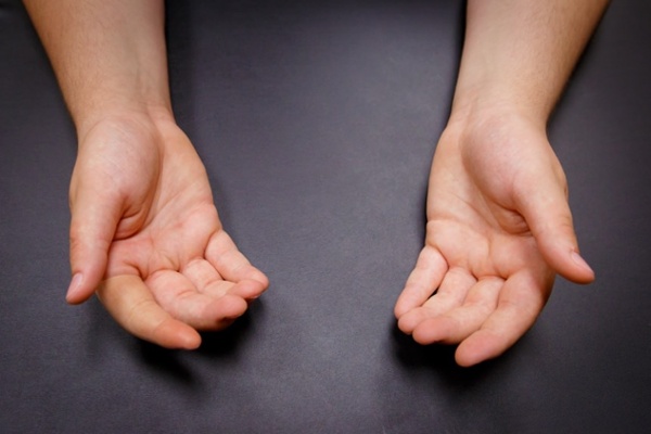 Arm Dynamics patient after silicone restoration of index finger