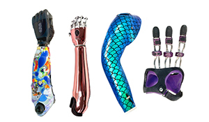 Personalized Prostheses