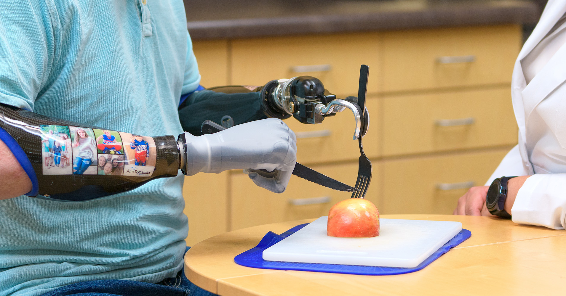 Activities of Daily Living (ADLs) for People with an Upper Limb Difference