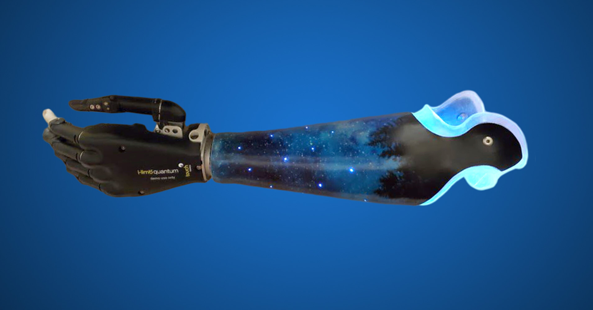Creativity and Prosthetic Devices