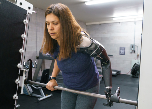 Claudia working out with her hybrid activity-specific prosthesis