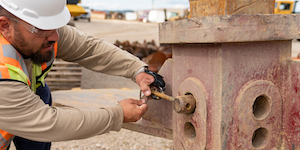 When An Amputation is the Result of a Work Accident: Introduction to Workers' Compensation