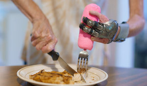 Eating When You Have an Upper Limb Difference
