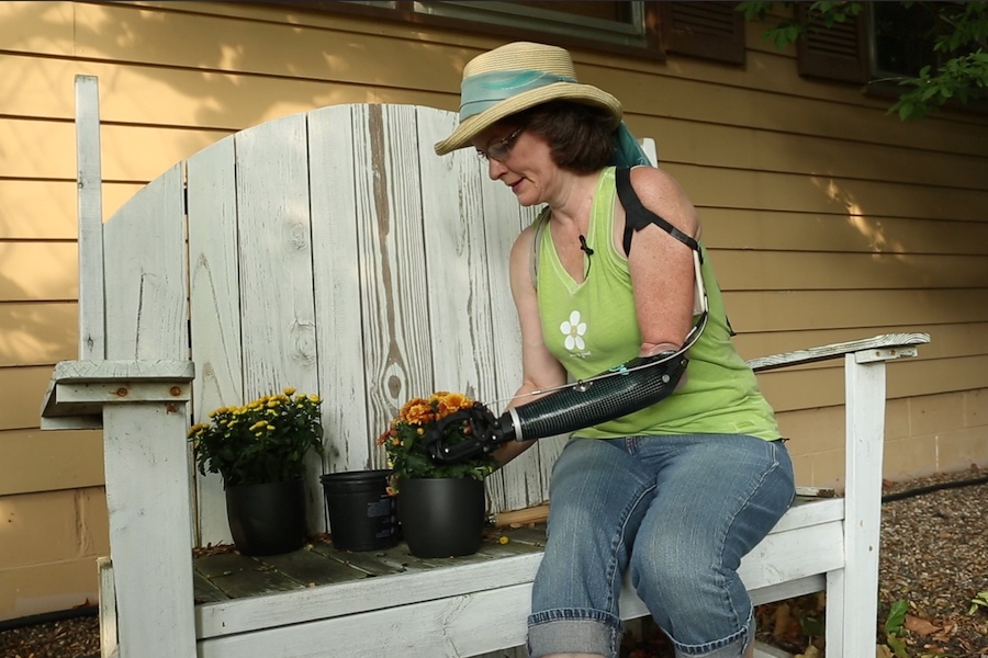 Gardening with a Prosthesis