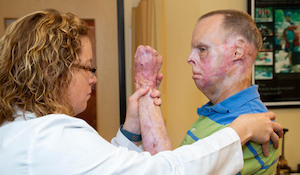 How Therapists May Help You Mitigate Pain After an Amputation