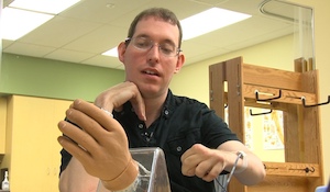 Elective Amputation of an Upper Limb
