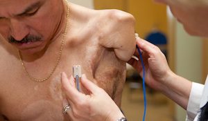 Introduction to Targeted Muscle Reinnervation (TMR)