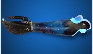Creativity and Prosthetic Devices
