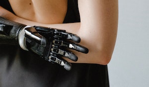 Celebrating Limb Difference Awareness Month 2021: Five Things That I’ve Learned